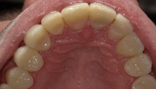 Close-up van het gebit met gezonde tanden en tandvlees.